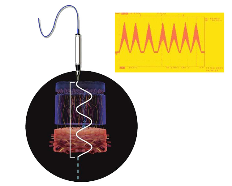 ペン型プローブ