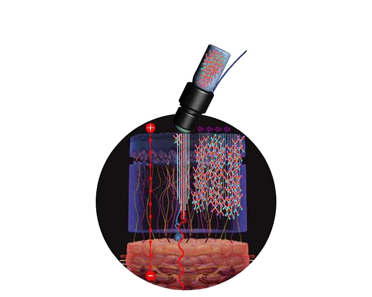 ローラー型プローブ