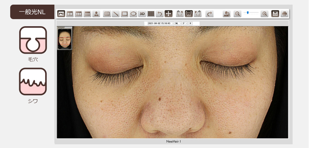 ネオヴォワール11