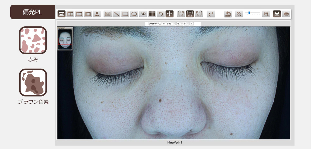 ネオヴォワール13