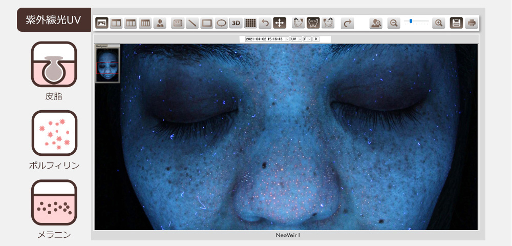 ネオヴォワール14