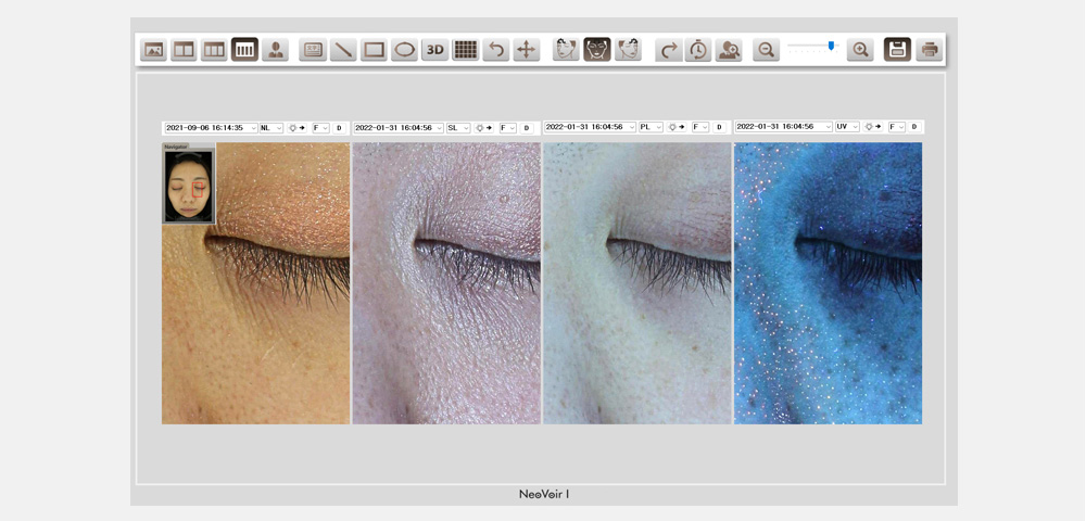 ネオヴォワール15