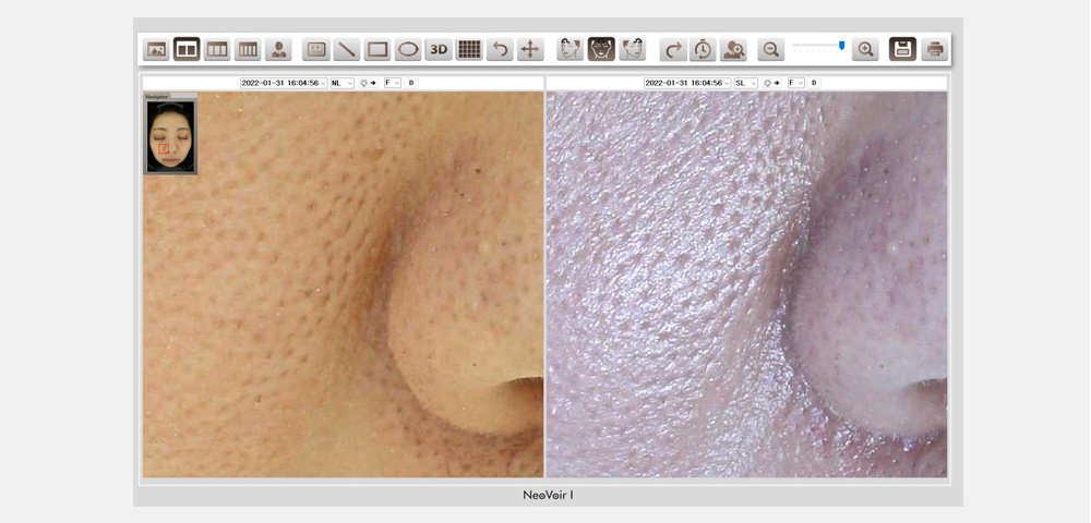 ネオヴォワール15