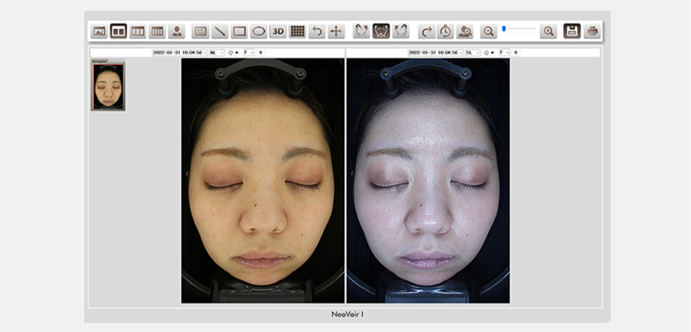 ネオヴォワール17