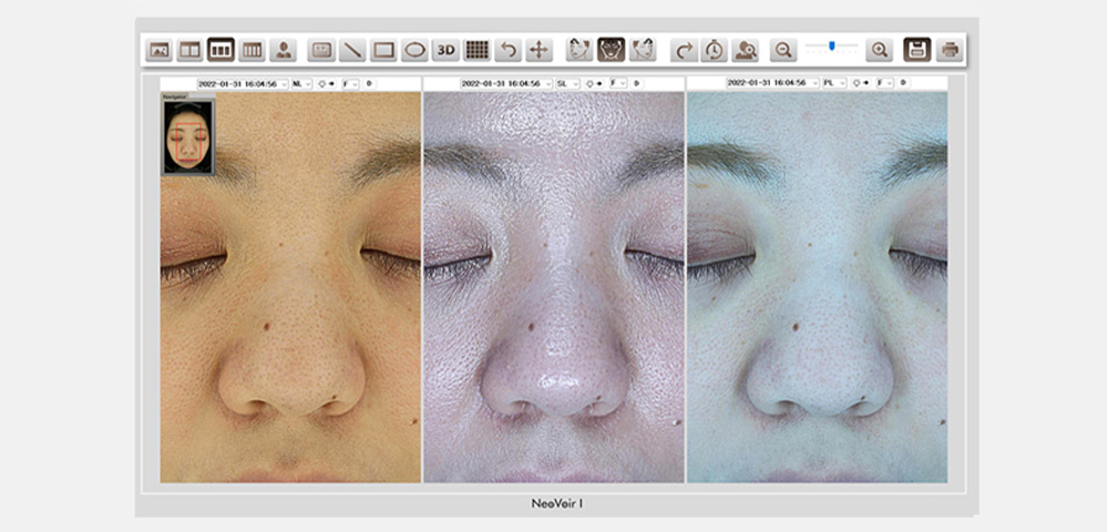 ネオヴォワール18