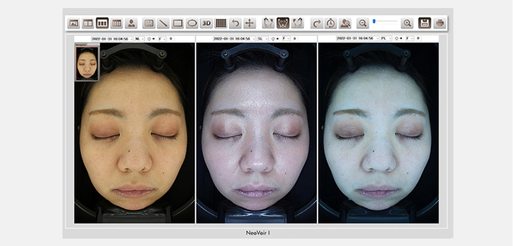 ネオヴォワール19