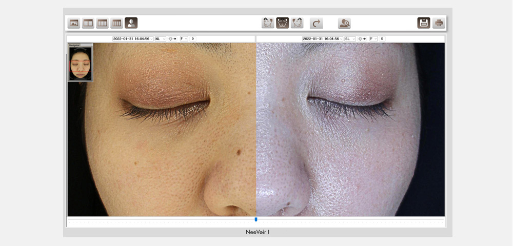 ネオヴォワール22