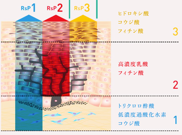 リバースピールの治療