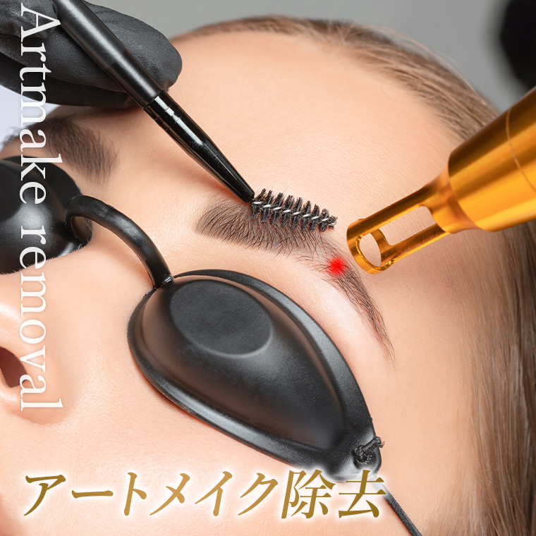 アートメイク除去